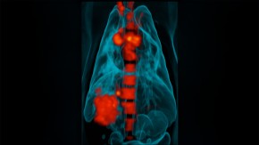 /sites/default/files/styles/listing_image/public/Understanding%20Latent%20Tuberculosis%20for%20Drug%20Discovery?itok=hT4H6pWq